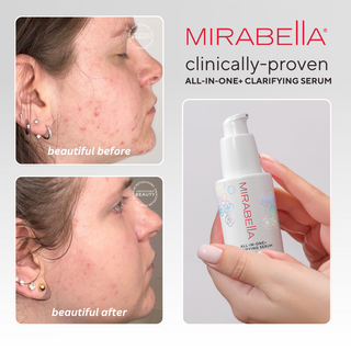 Image of models Before and After in house clinical face comparison along side model holding All-In-One + Clarifying Serum bottle.