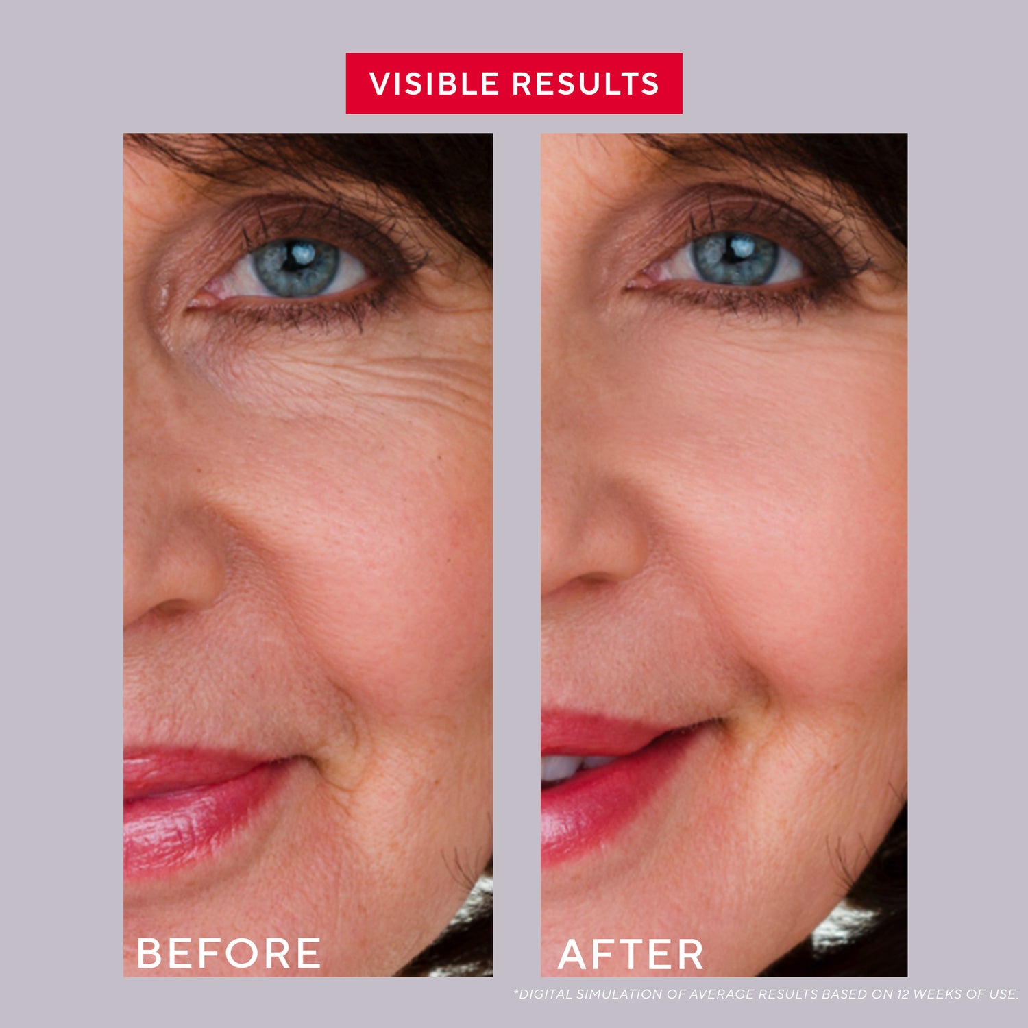 Mirabella Beauty Replenish & Restore Multi-Peptide Serum - Retinol and Vitamin C Serum for Face Before and After Visible Results